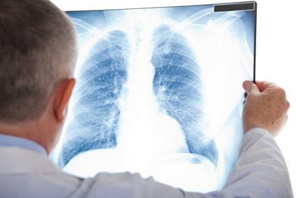 Arzt Lungenbild